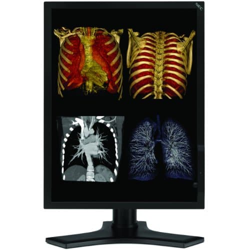 NEC MD213MC - Monitor
