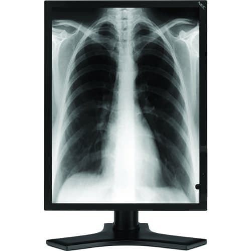 NEC MD213MG - Monitor