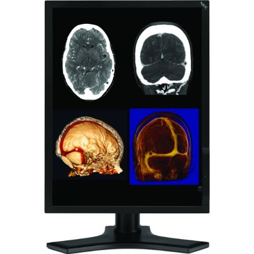 NEC MD212MC - Monitor